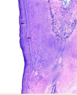 A twoyearold bear The permanent premolar erupts by three months of age The first distinct annulus separated from the cementumdentine junction is deposited during the 1st winter of life Two distinct annuli present in this picture These pictures are from samples from brown bears prepared for Kodiak biologist Nate Svoboda by Jesse White and Arthur Stephens Matsonrsquos Laboratory