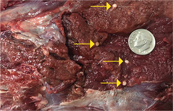 Tapeworm cysts in muscle