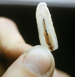 A tooth root longitudinal section The crown the quottoothquot part thatrsquos visible above the gum is cut off The center of the section which looks hollow is the pulp cavity and contains blood and tissue when the tooth is alive Therersquos dentine on both sides of that then cementum The ager looks at both sides but usually one side has better cementum with more distinct annuli strong strong