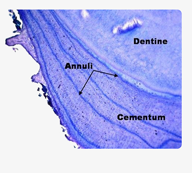 The annuli in a bear tooth root The slice is stained to enhance the features