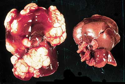 Liver from healthy rodent right and rodent with Echinococcus multilocularis